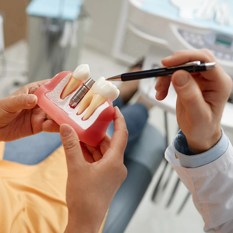 Tratamientos dentales en Clinica Dentales Amimarte